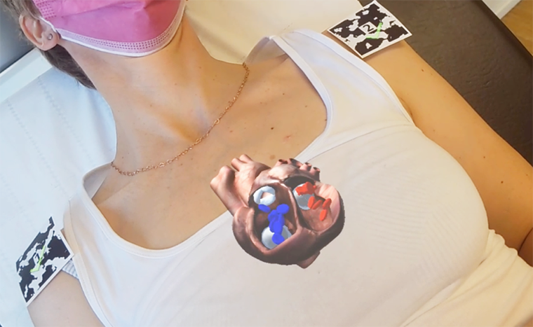 Blick durch die AR-Brille mit CareTrain